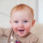 atopic diathesis in a child