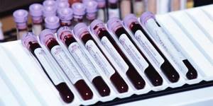 Больше информации об аллергенах поможет получить иммунологический анализ крови.