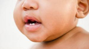 Детские молочные зубы с нервами или нет?