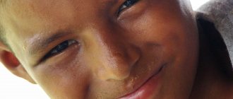 Cold sweat in a child