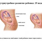 Image No. 1: 29 weeks of pregnancy - IVF blog