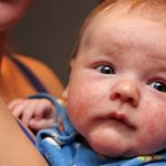 Какие лучше глазные капли от аллергии для детей