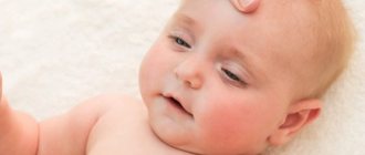Crust on the face of a baby