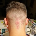 Red spots on the head may indicate the presence of lichen