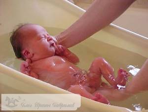 купание новорождённого после отпадения пупка