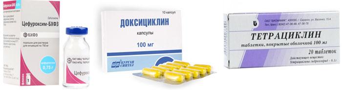Лекарственные препараты для лечения дакриоцистита