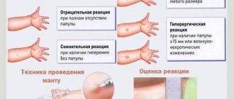 Mantoux and colds (runny nose, throat)