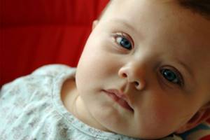 Мешки под глазами у ребенка причины и лечение