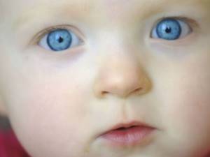 Мешки под глазами у ребенка причины и лечение