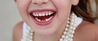 Молочные зубы у детей схема выпадения
