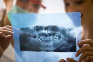 Можно ли лечить зубы при лактации