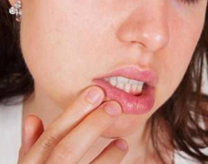Опухла губа: аллергическая реакция