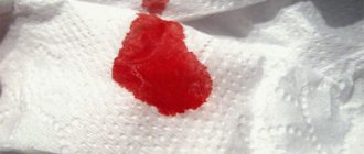 Понос с кровью у ребенка: возможные причины, способы лечения, патология с температурой и без