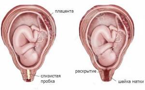 Предвестники родов у первородящих. Как начинаются, сколько длятся, когда ехать в роддом. Симптомы и признаки в конце беременности