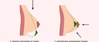 Reasons for changes in breast shape