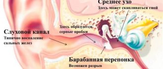 Plugs in a child’s ears: what to do, how to remove them at home