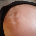 родничок у грудничка