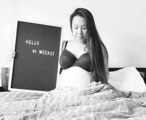 роды на 41 неделе беременности