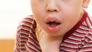 Симптомы пищевой аллергии у детей могут быть разными: от высыпаний до отека.