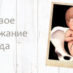 Breech presentation of the fetus