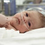 Тяжелая асфиксия новорожденных последствия