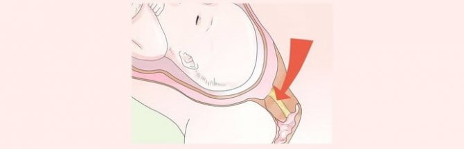 Узнайте как выглядит слизистая пробка перед родами у повторнородящих мам