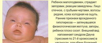 врожденный гипотиреоз и его проявления