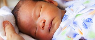 Jaundice in a newborn