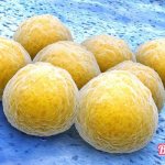 Staphylococcus aureus in infants: symptoms, treatment, photos